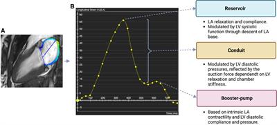 Atrial cardiomyopathy: Current and future imaging methods for assessment of atrial structure and function